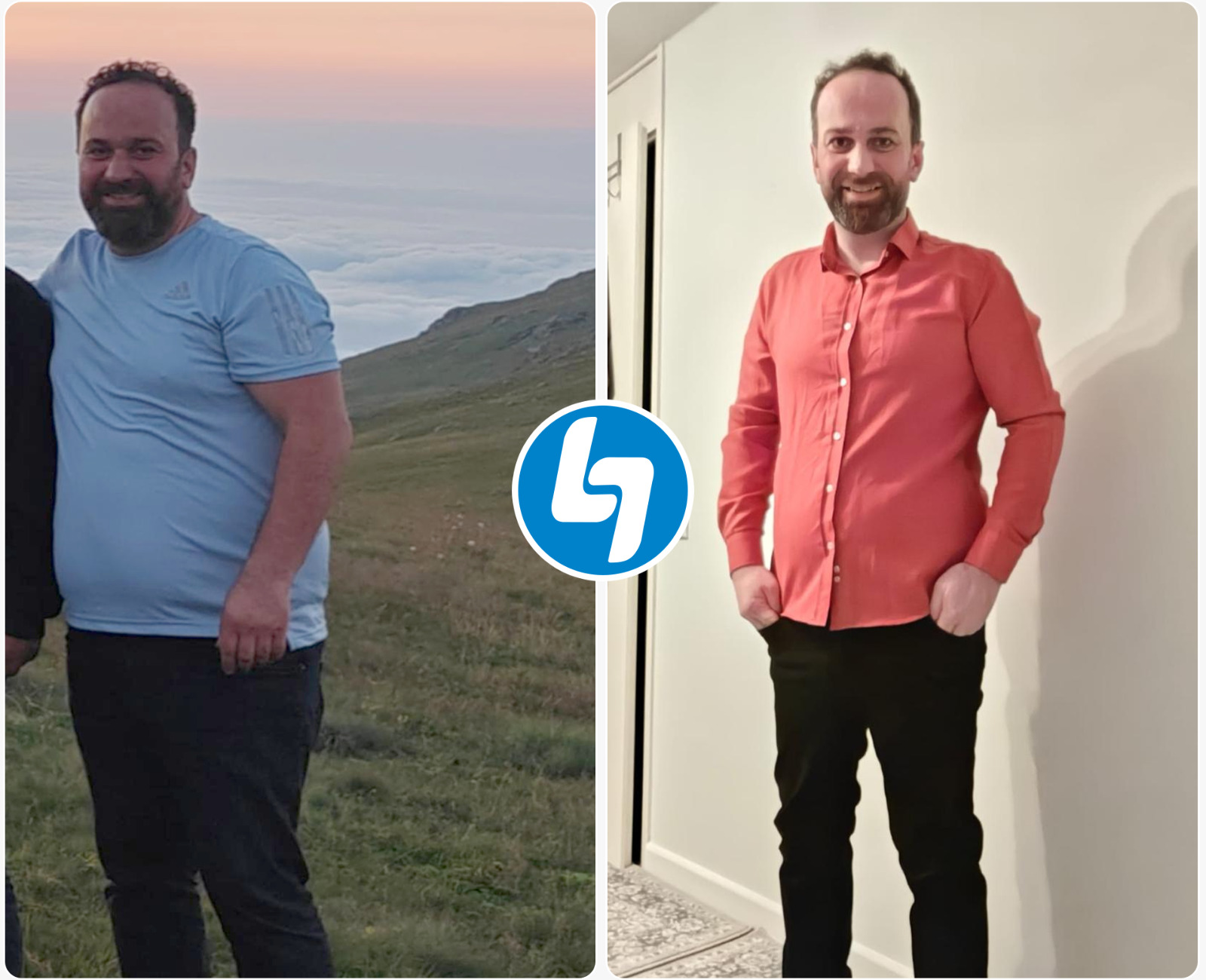 Gastric bypass surgery